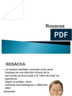 Rosacea