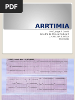 ARRTIMIA