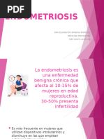 endometriosis