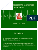 Electrocardiograma y Arritmia