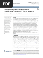 Deep learning-assisted arrhythmia classification using 2-D ECG spectrograms