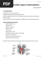 ED3 - Les Tachycardies Supra-Ventriculaires Finale (1)