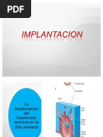 Implantacion y Embrion Bilaminar