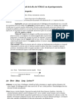 Interpretacion y Utilidad de La RX de Torax