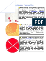 Identificación de Especies Haemophilus