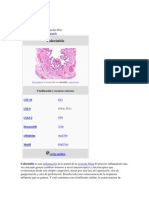 Colecistitis