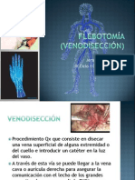 Flebotomía (Venodisección)