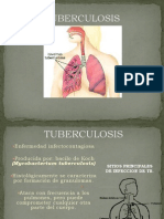 Tuberculosis