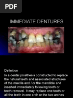 Immediate Dentures