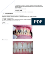 Qué Son Los Dientes