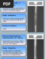 RADIOGRAFIA