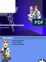 Eritema Infeccioso