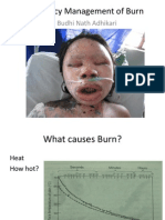 Emergency Management of Burn