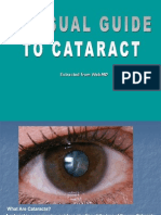 Visual Guide To Cataract