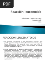 Reacción Leucemoide - Ivan Omar Limon Uscanga 1004