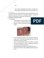 Biopsia en Cirugia Bucal