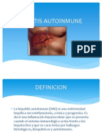 Hepatitis Autoinmune