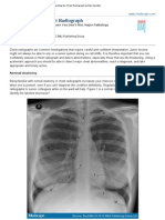 Interpreting The Chest Radio Graph Friendly)