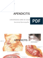 Apendicitis