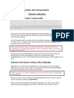 ACLS EKG Rhythms and Interpretation