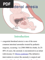 Duodenal Atresia.....