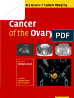 Ovarian Cancer