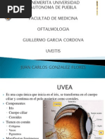 UVEITIS