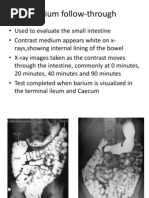 Barium Follow-Through TBL