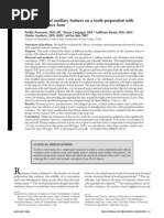 The Effectiveness of Auxiliary Features On A Tooth Preparation With Inadequate Resistance Form