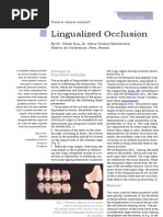 Lingualized Occlusion Review