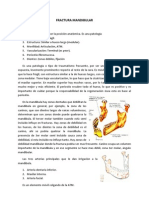 Fractura Mandibular