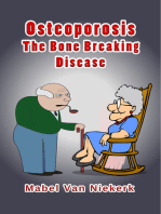 Osteoporosis: The Bone Breaking Disease