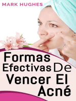 Formas Efectivas De Vencer El Acné