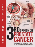 3rd Opinion on Prostate Cancer