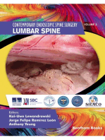 Lumbar Spine