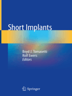 Short Implants