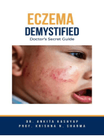 Eczema Demystified: Doctor's Secret Guide