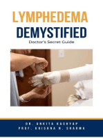 Lymphedema Demystified: Doctor’s Secret Guide