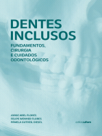 Dentes inclusos: fundamentos, cirurgia e cuidados odontológicos