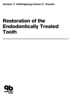 Restoration of the Endodontically Treated Tooth