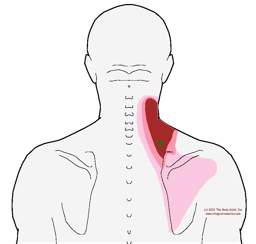 Self Care - Stiffness up the side of the neck - Integrative Works