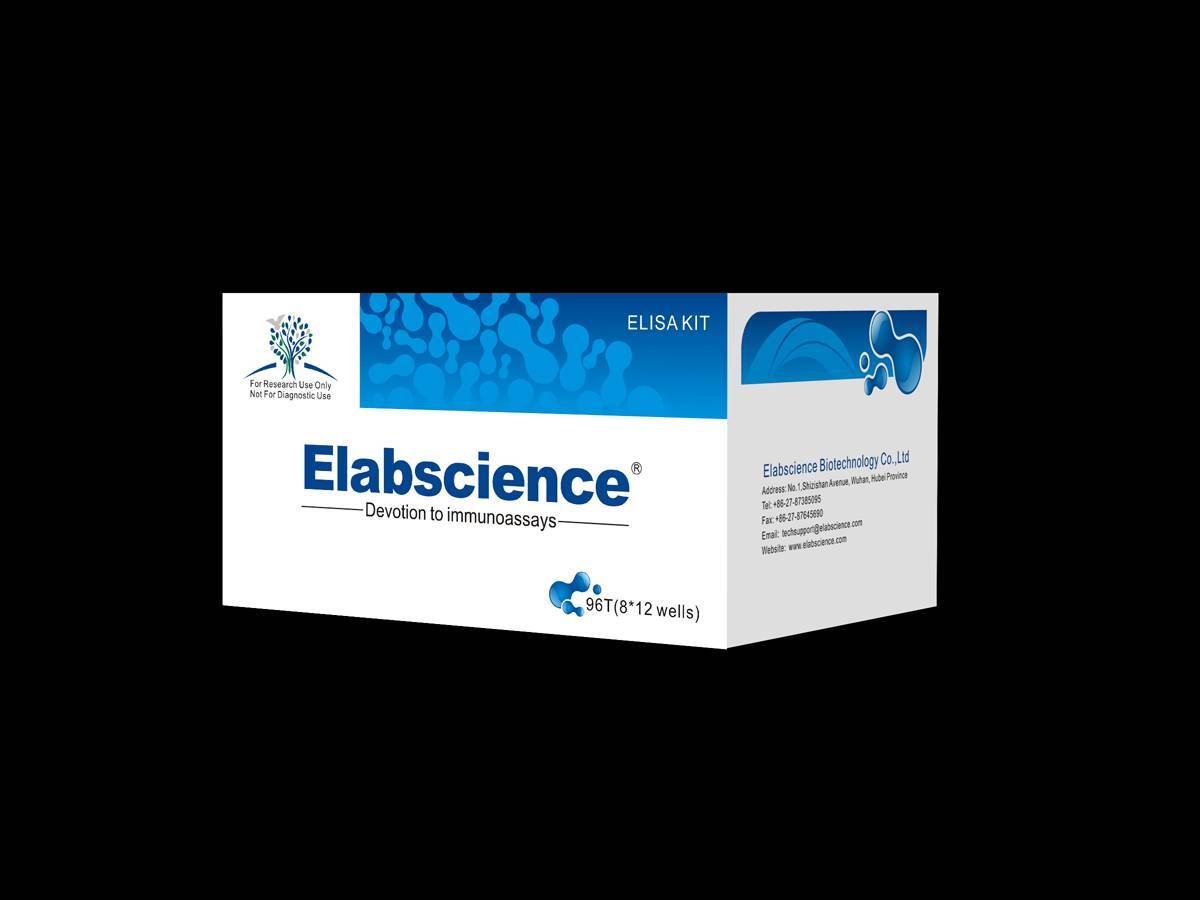 Human Anti-dsDNA (Anti-Double Stranded DNA Antibody) ELISA Kit - Wuhan ...