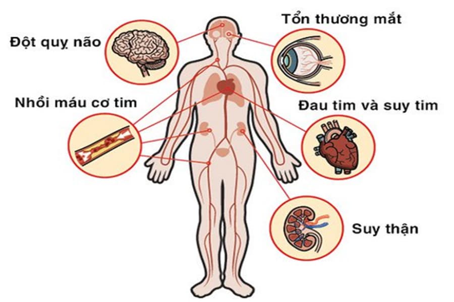 Tổn thương cơ quan đích do tăng huyết áp