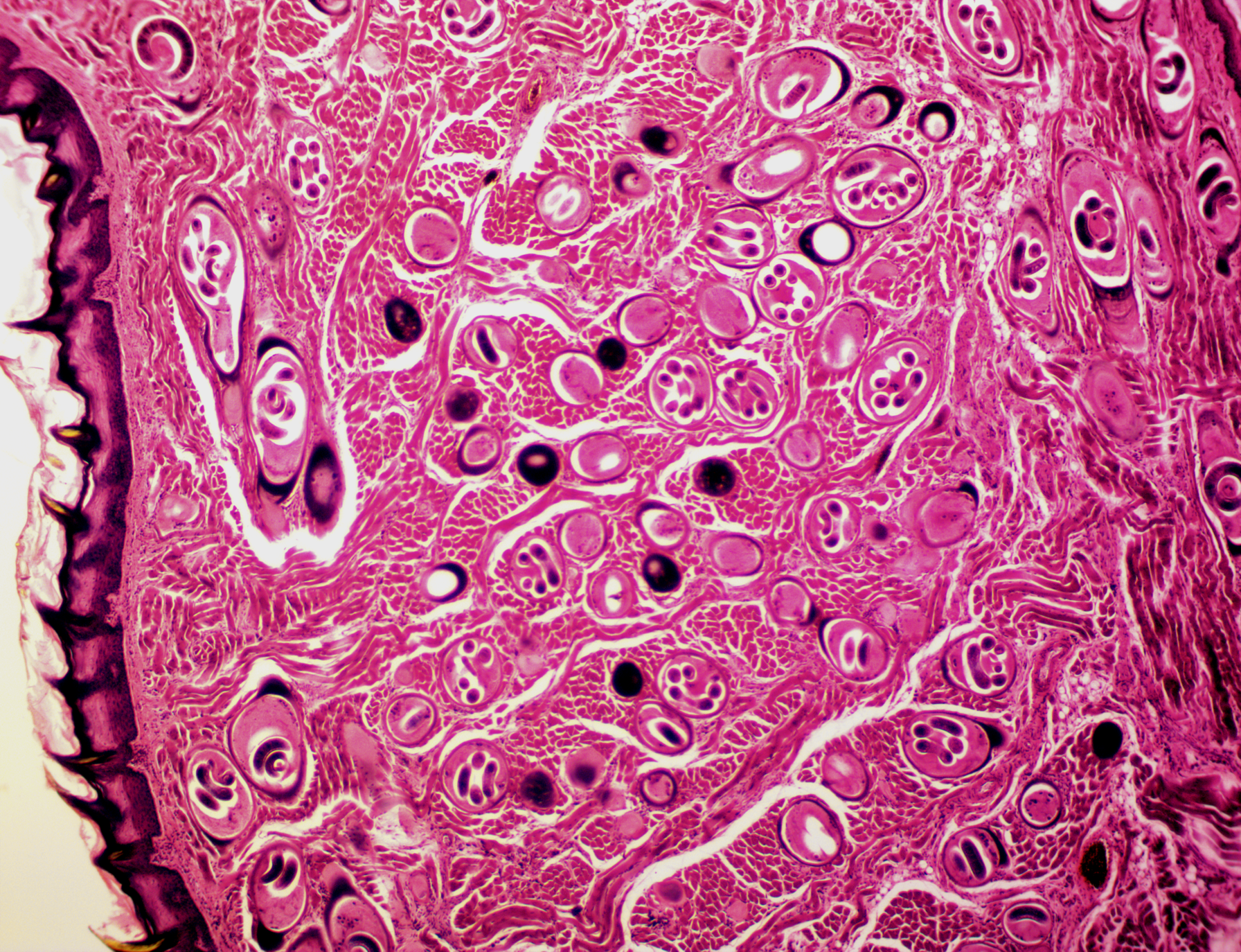 File:Trichinella Spiralis x.s. & l.s. 40x.png - Wikimedia Commons