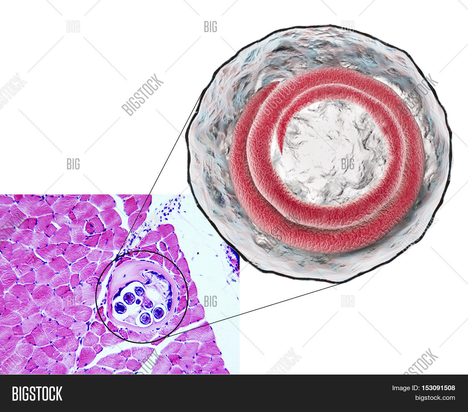 3D Illustration Micrograph, Image & Photo | Bigstock