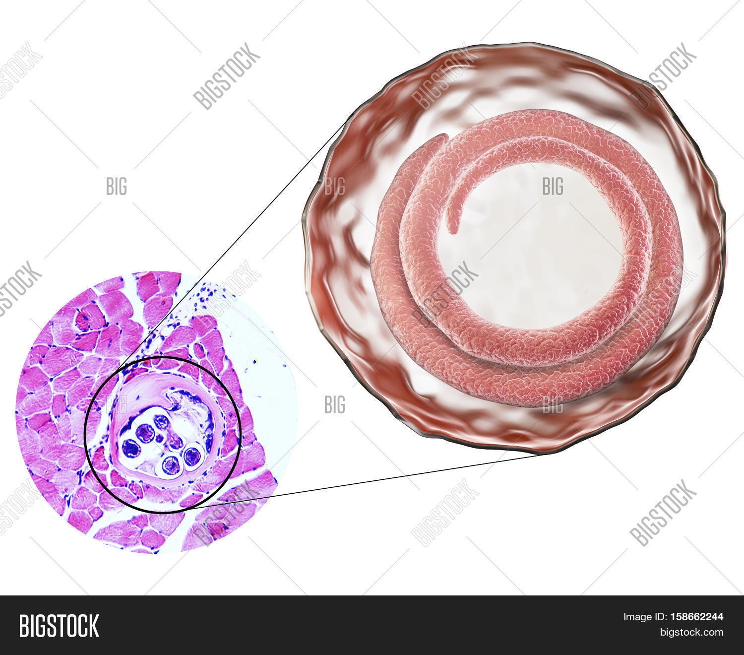 3D Illustration Micrograph, Image & Photo | Bigstock