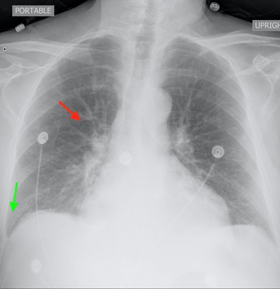 J Med Cases