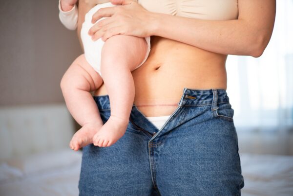 A woman holding a baby in a diaper against her hip. Her jeans are unbuttoned, revealing a faint scar on her lower abdomen, possibly from a recent cesarean section.