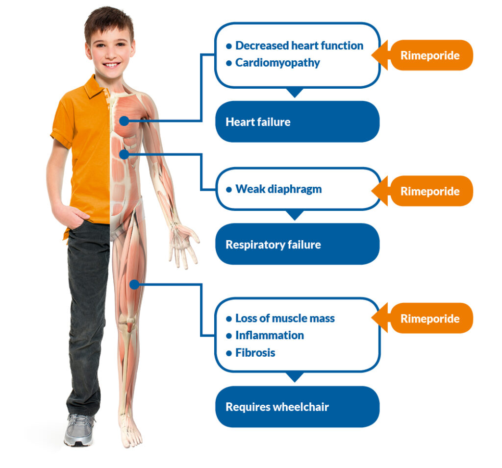 INHERITED DISEASES—MUSCULAR DYSTROPHIES