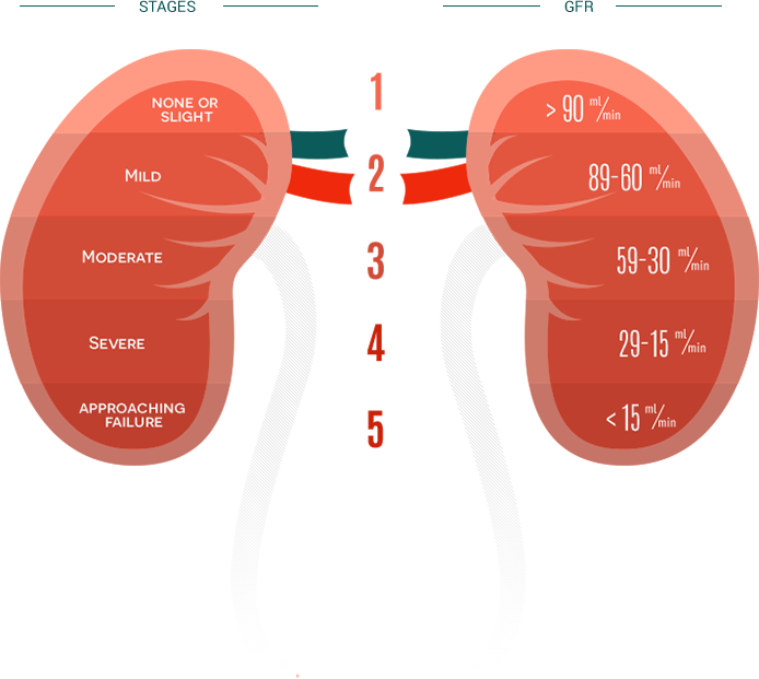 Kidney Disease Stages Chart | Labb by AG